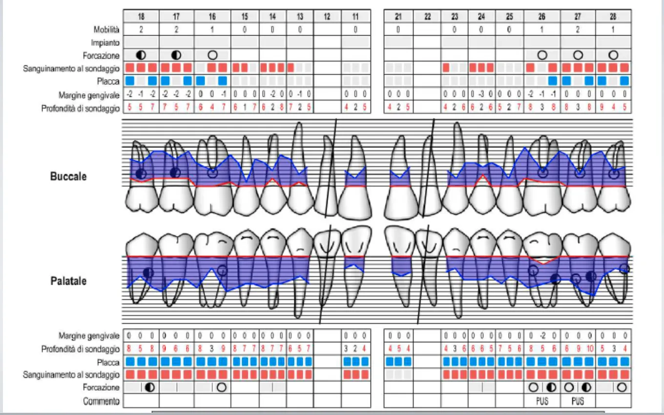 Esempio di cartella parodontale