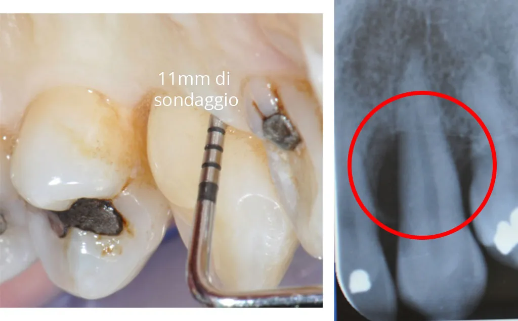 Chirurgia rigenerativa pre-operatoria